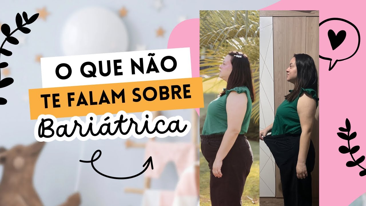 Meu relato de 3 meses de cirurgia bariátrica - quase morri.