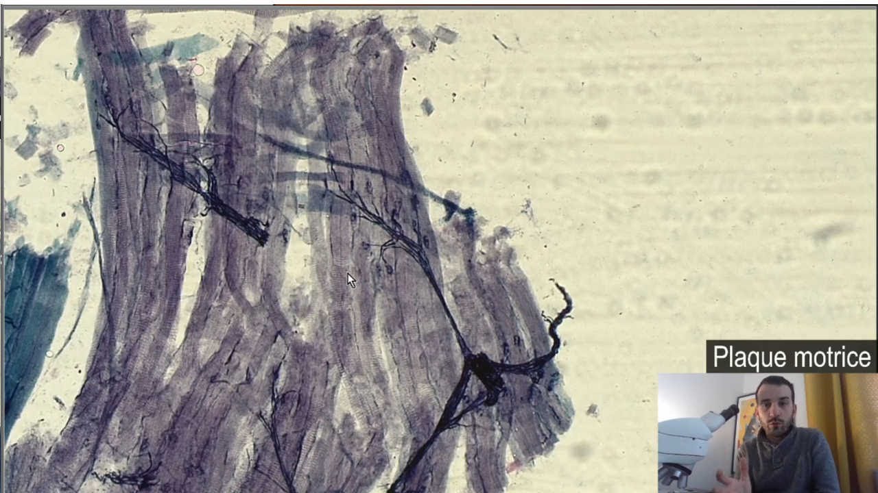 Histologie : La plaque motrice ou jonction neuro-musculaire et muscle stri&eacute; squelettique.