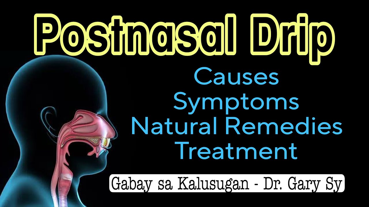 Postnasal Drip: Causes, Symptoms, Natural Remedies & Treatments - Dr. Gary Sy