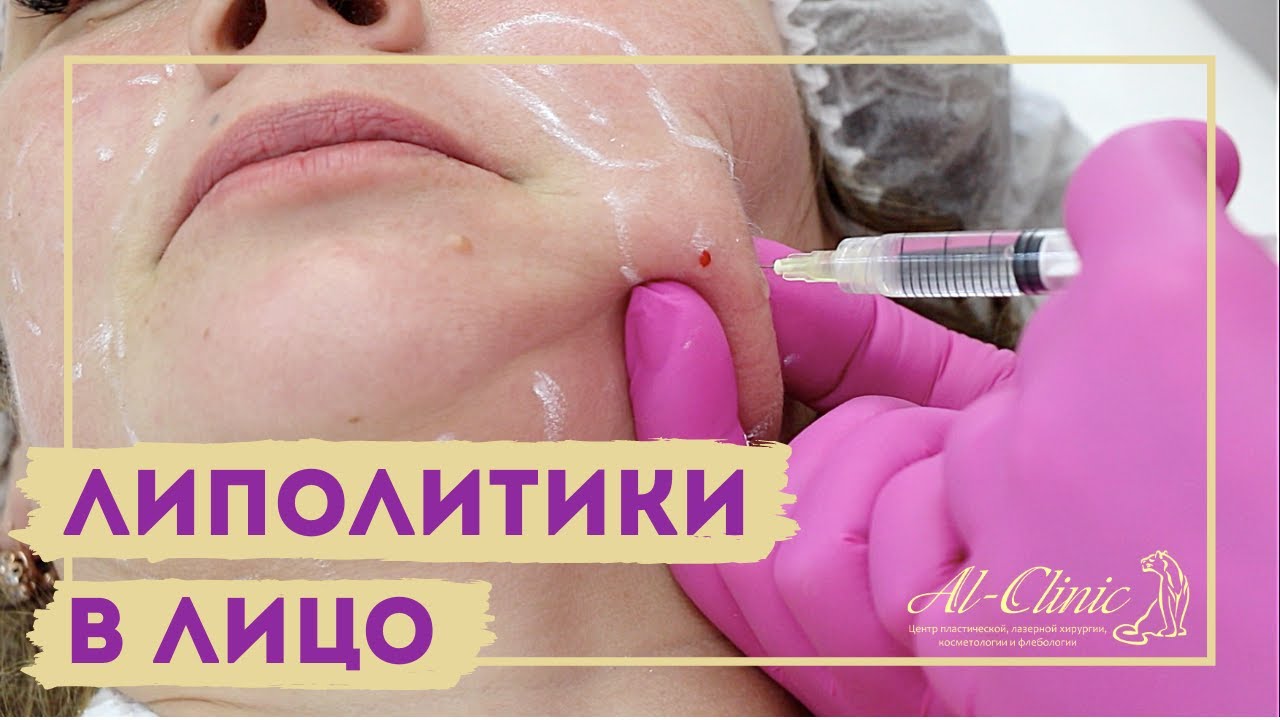 ХУДЕЕМ БЫСТРО | ЛИПОЛИТИКИ В ЛИЦО | Избавляемся от второго подбородка | 