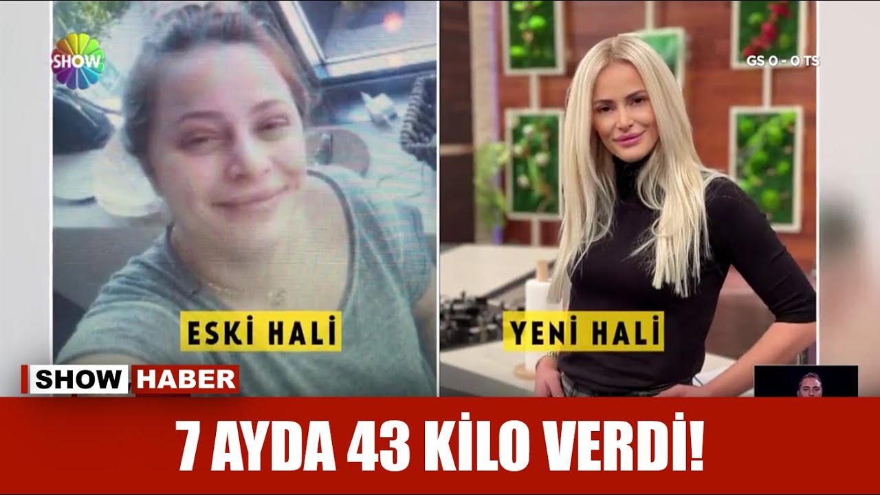 7 ayda 43 kilo verdi!