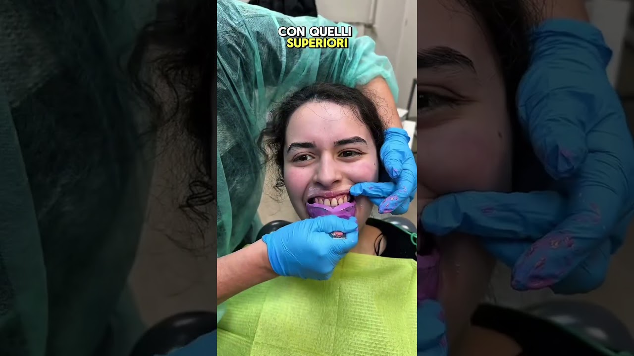 FINALMENTE METTO L&rsquo;APPARECCHIO PER I DENTI 😍🦷