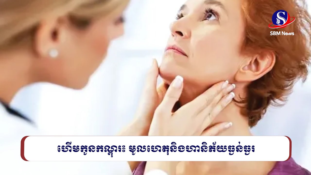 ហើមកូនកណ្ដុរ៖ មូលហេតុនិងហានិភ័យធ្ងន់ធ្ងរ | SBM NEWS