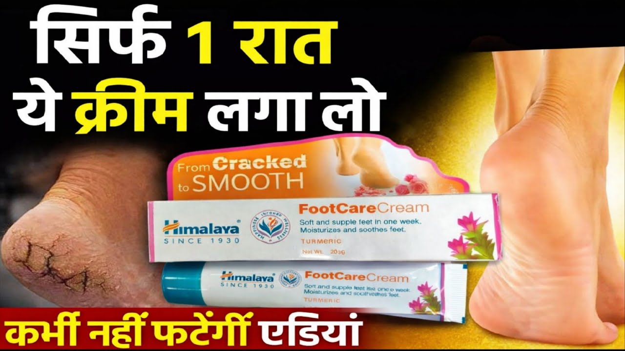 himalaya foot care cream | cracked heels cream | edi fatane ka cream | Cracked Heels Treatment