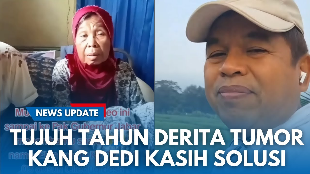 KDM GERCEP GAK BANYAK OMONG! Respons soal Warga Ciamis 7 Tahun Alami Tumor, Dibawa ke RS Welas Asih