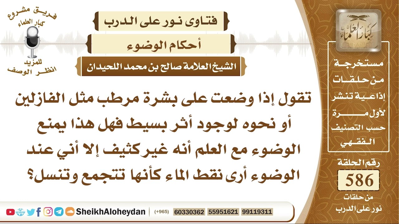 7232 - حكم وضع الفازلين أو نحوه فهل هذا يمنع الوضوء ؟ -  نور على الدرب