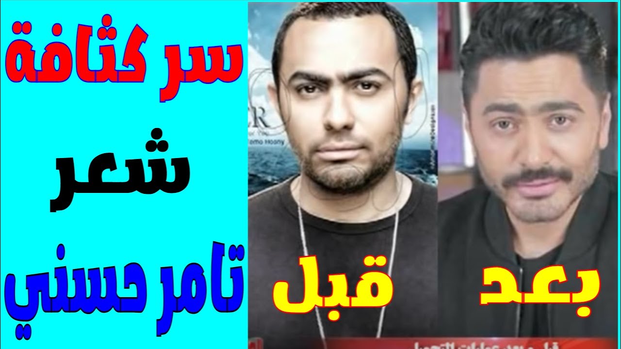 سر شعر تامر حسني  I  برنامج البسيط