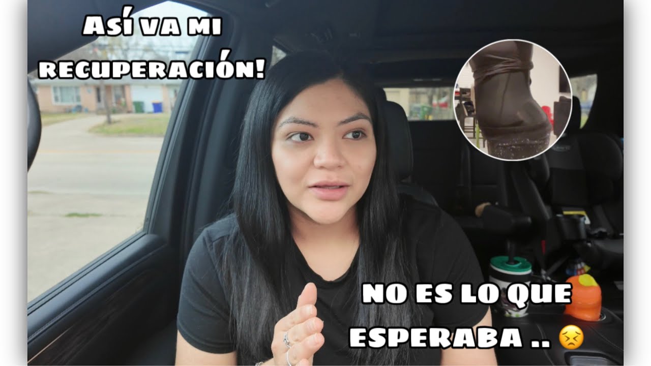 ME ARREPIENTO DE MI CIRUGÍA!? 😪 | NO ES LO QUE ESPERABA.. 