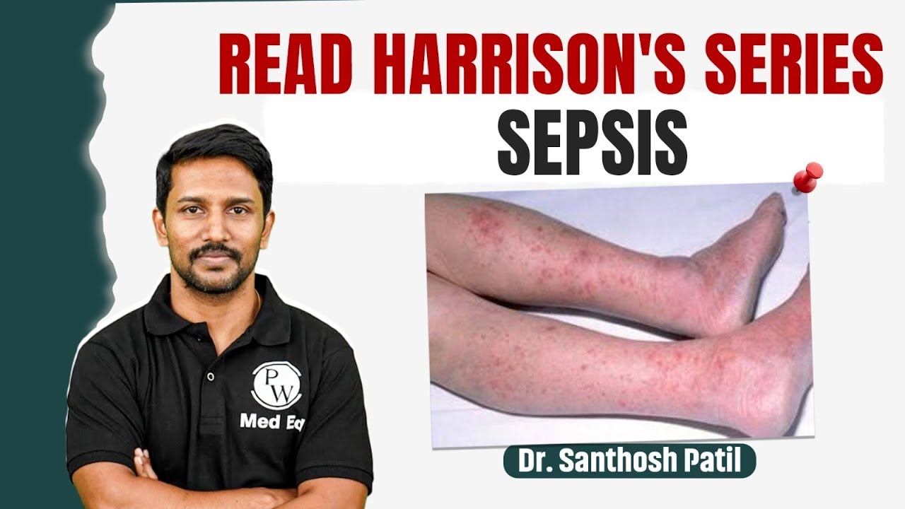 Sepsis | Medicine | Read Harrison’s Series | 4th Year MBBS Pathology | Dr Santhosh Sir