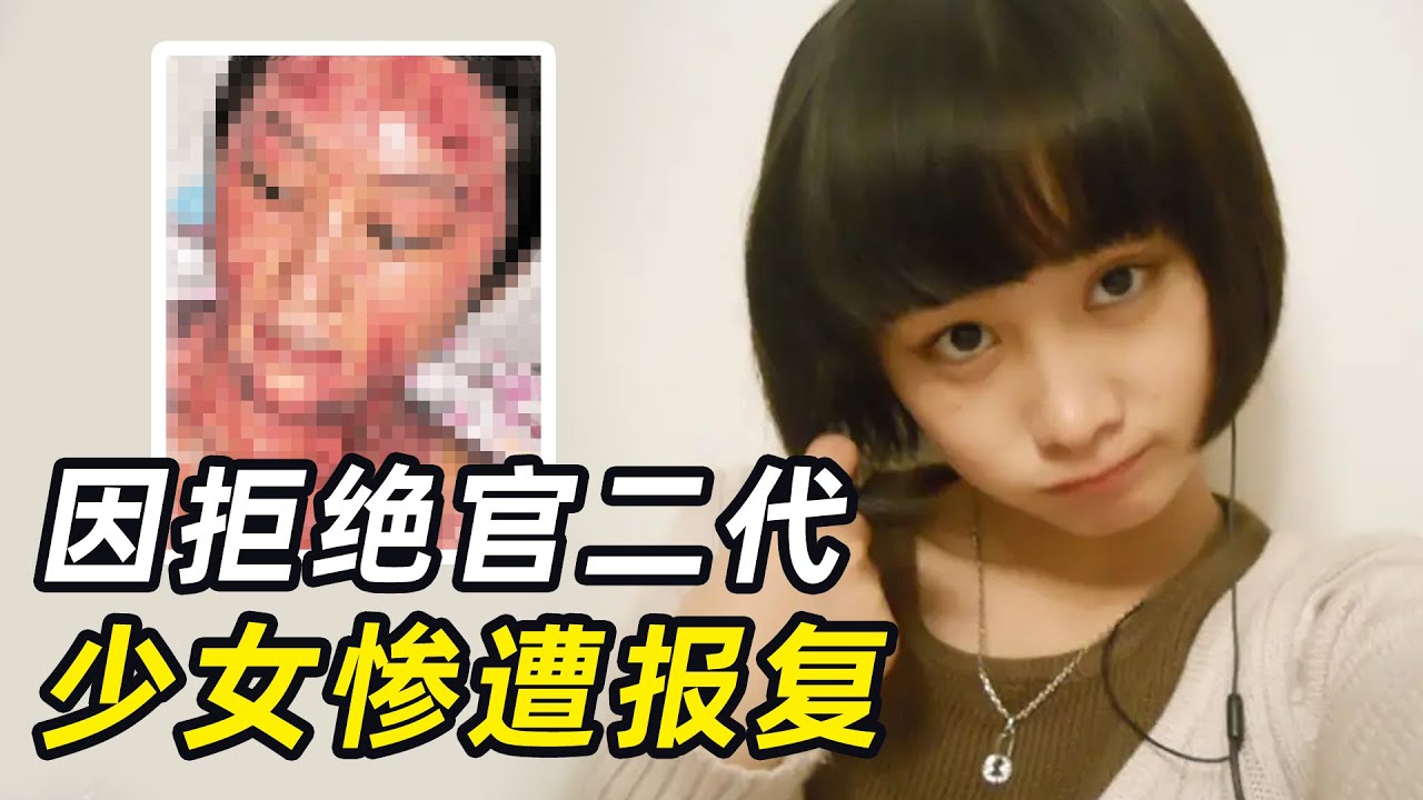 拒绝官二代，花季少女惨遭报复，全身28%烧伤，惨不忍睹