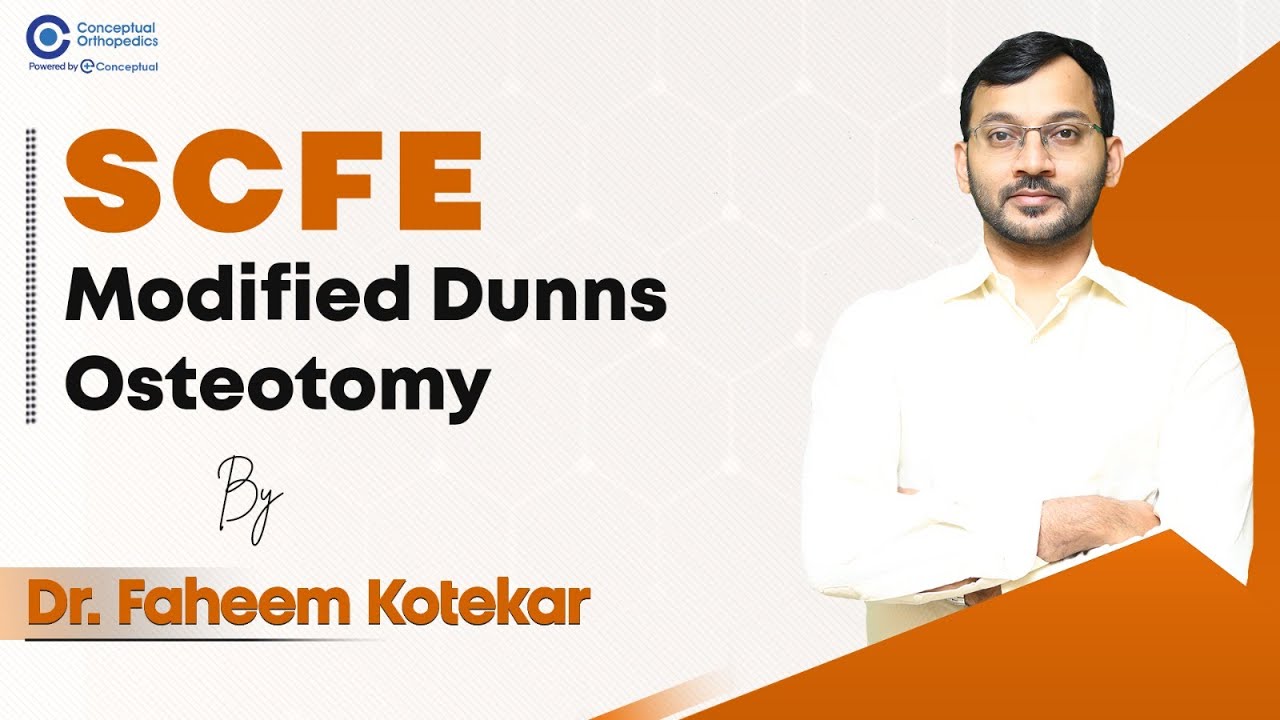 SCFE  Modified Dunns Osteotomy by Dr.Faheem Kotekar @ConceptualOrthopedics