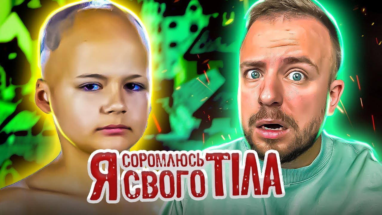 Я СОРОМЛЮСЬ СВОГО ТІЛА ► Лікарі не допоможуть? Вперше в історії проєкту