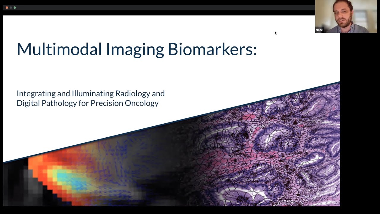Multimodal Imaging Biomarkers- Radiology and Digital Pathology: Nathaniel Braman, 18th July 2022