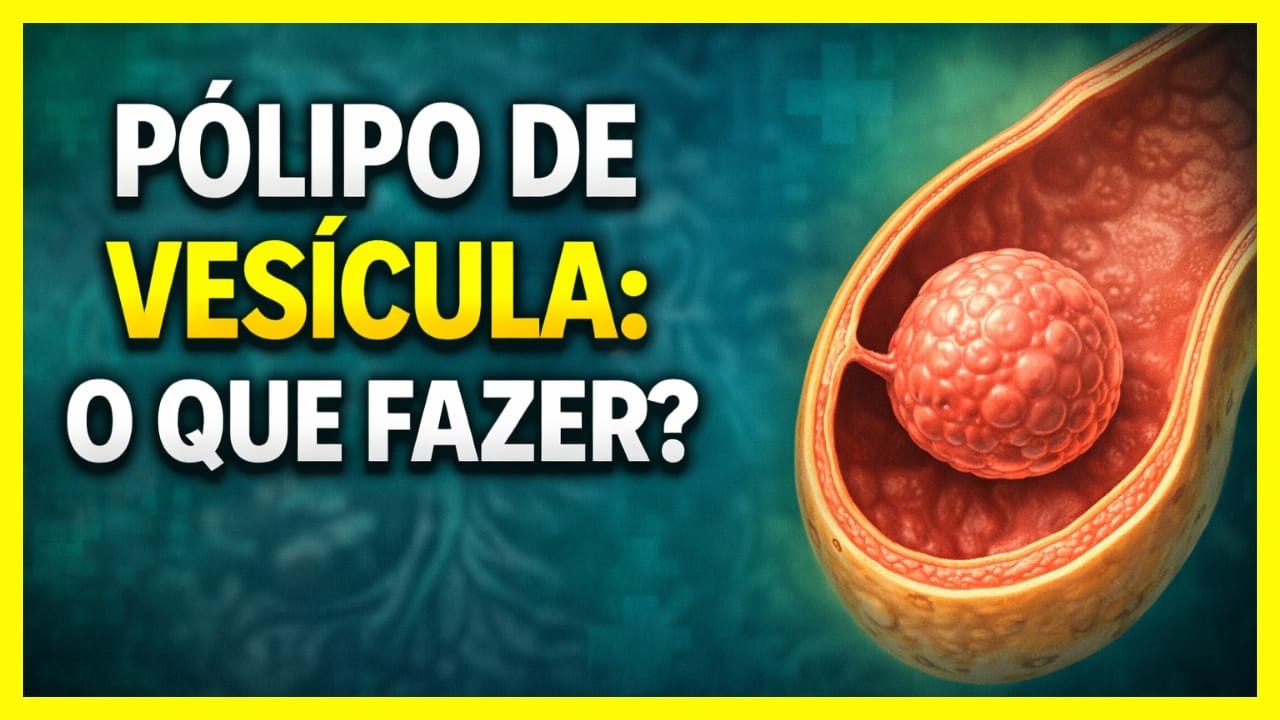 Pólipo de Vesícula - o que é e o que fazer?