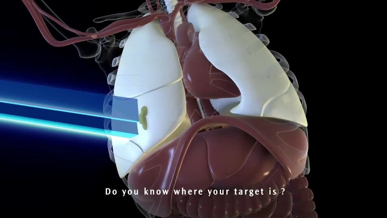 Symmetry - Managing Respiratory Motion