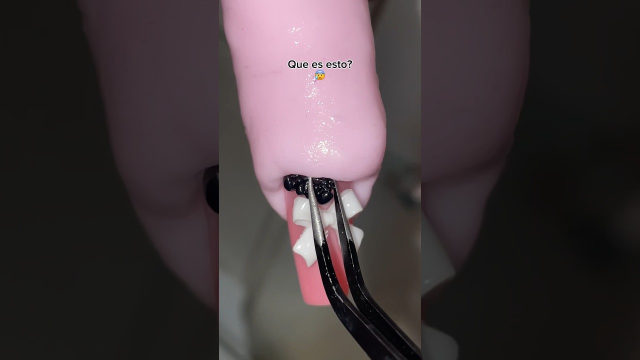 Hay algo ATRAPADO DEBAJO de mi cut&iacute;cula😱🫣
