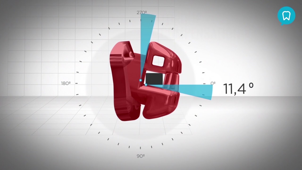 Torque Compensation with Insignia System
