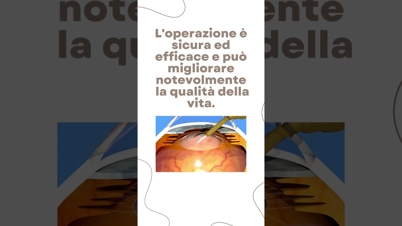 Soffri di visione sfocata o appannata?