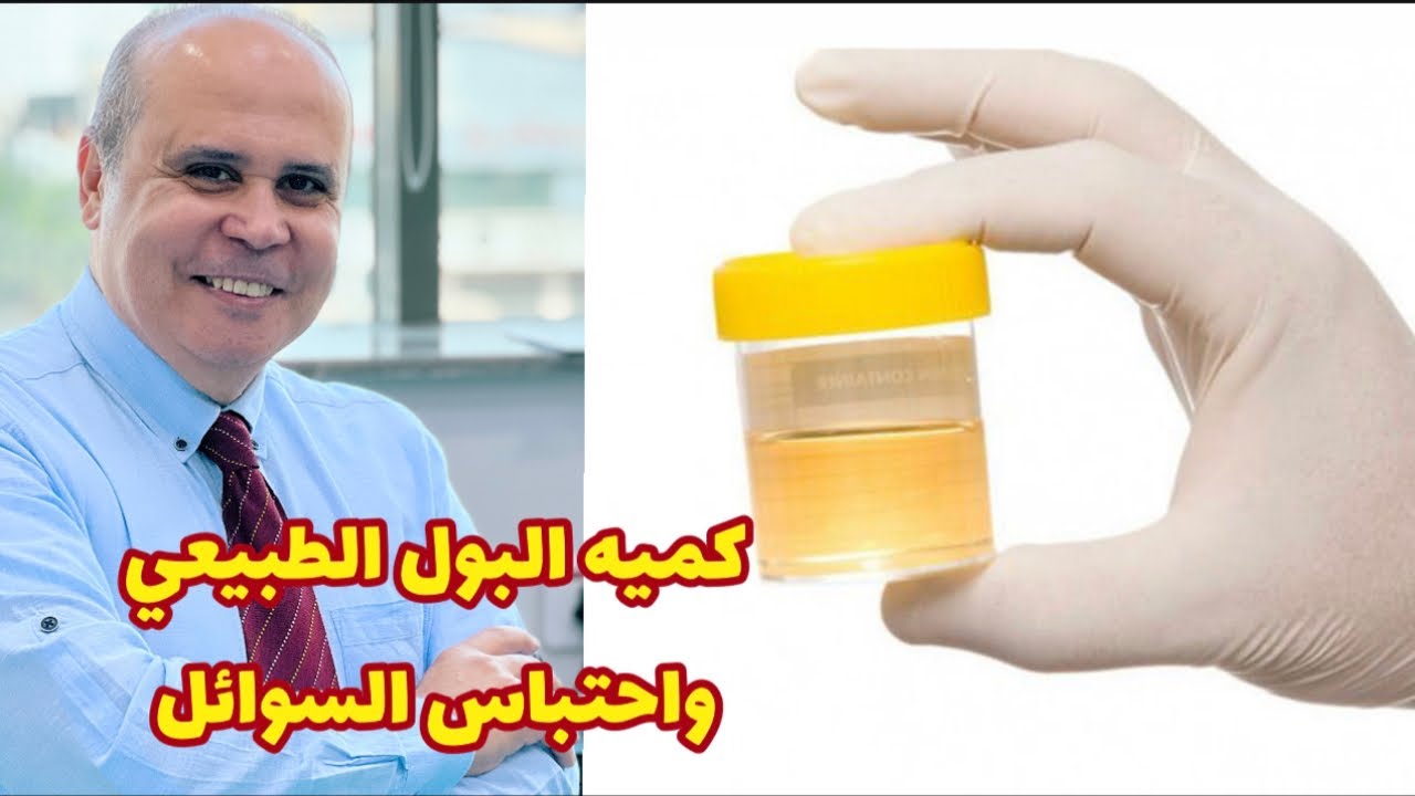 Знаете ли вы, сколько мочи в норме вырабатывает ваш организм в день? 👌 Как узнать, связано ли это...