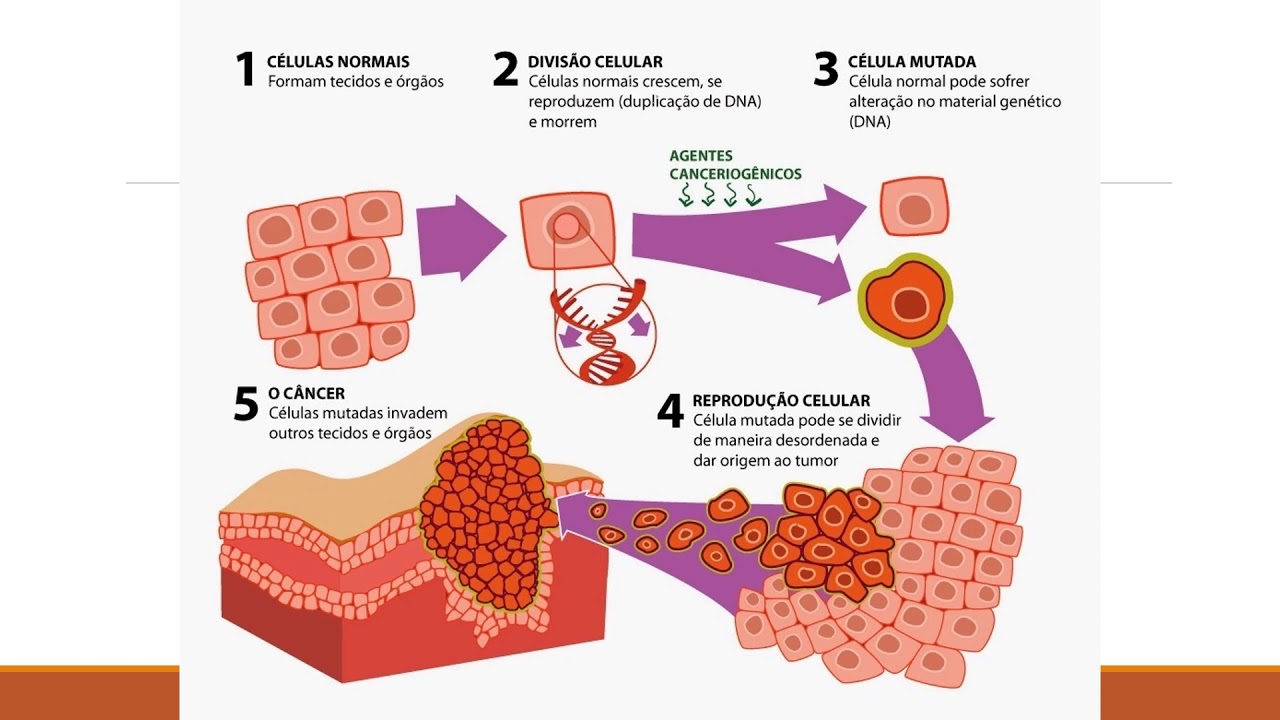 Displasia e Neoplasia