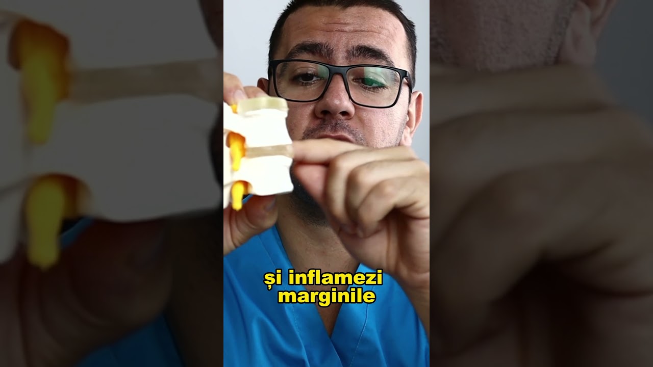 Ce Poți Face Dacă Ai Osteofite la Nivelul Coloanei?