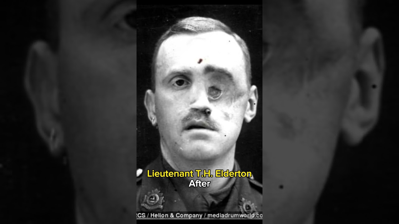 people before and after War 