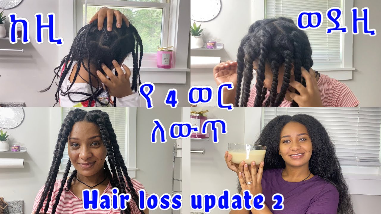 🦋የተነቀለው ፀጉሬ እንዴት ተመለሰ የሚታይ ለውጥ ቀጣይ ቪድዮ/ hair loss update video 2￼