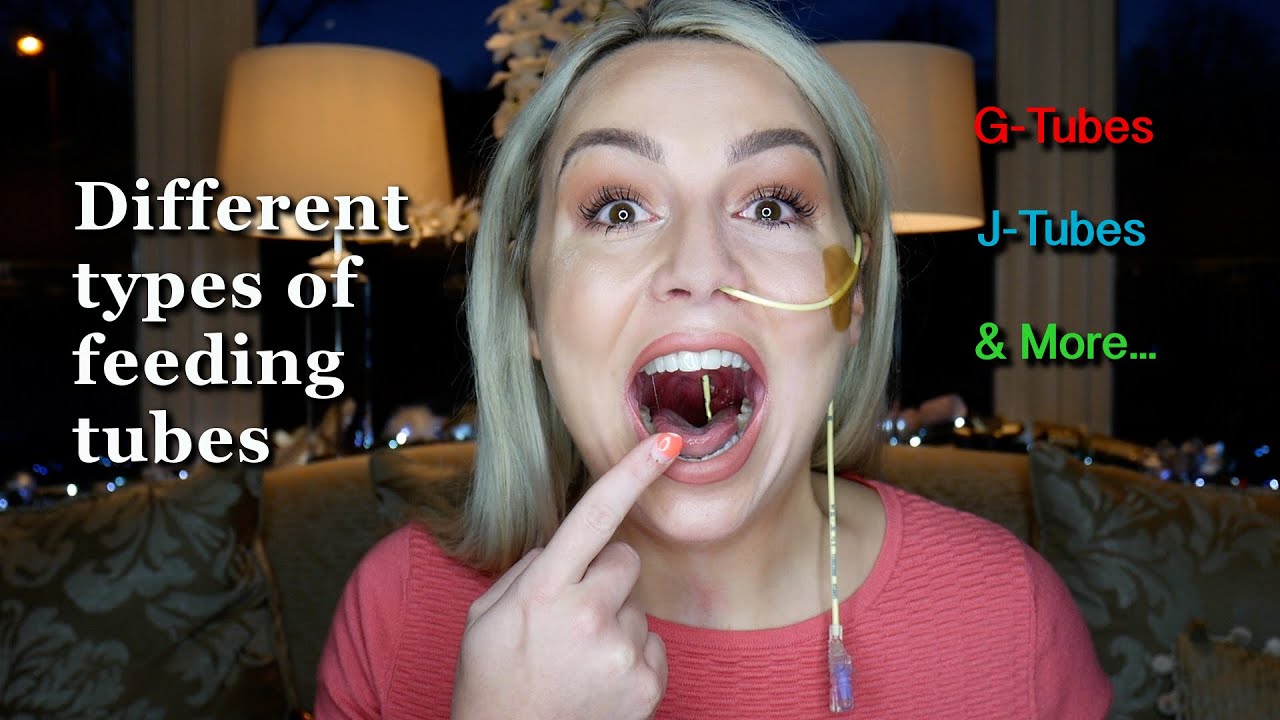 Different types of feeding tube EXPLAINED! NG/ND/NJ/G/GJ & J Tubes