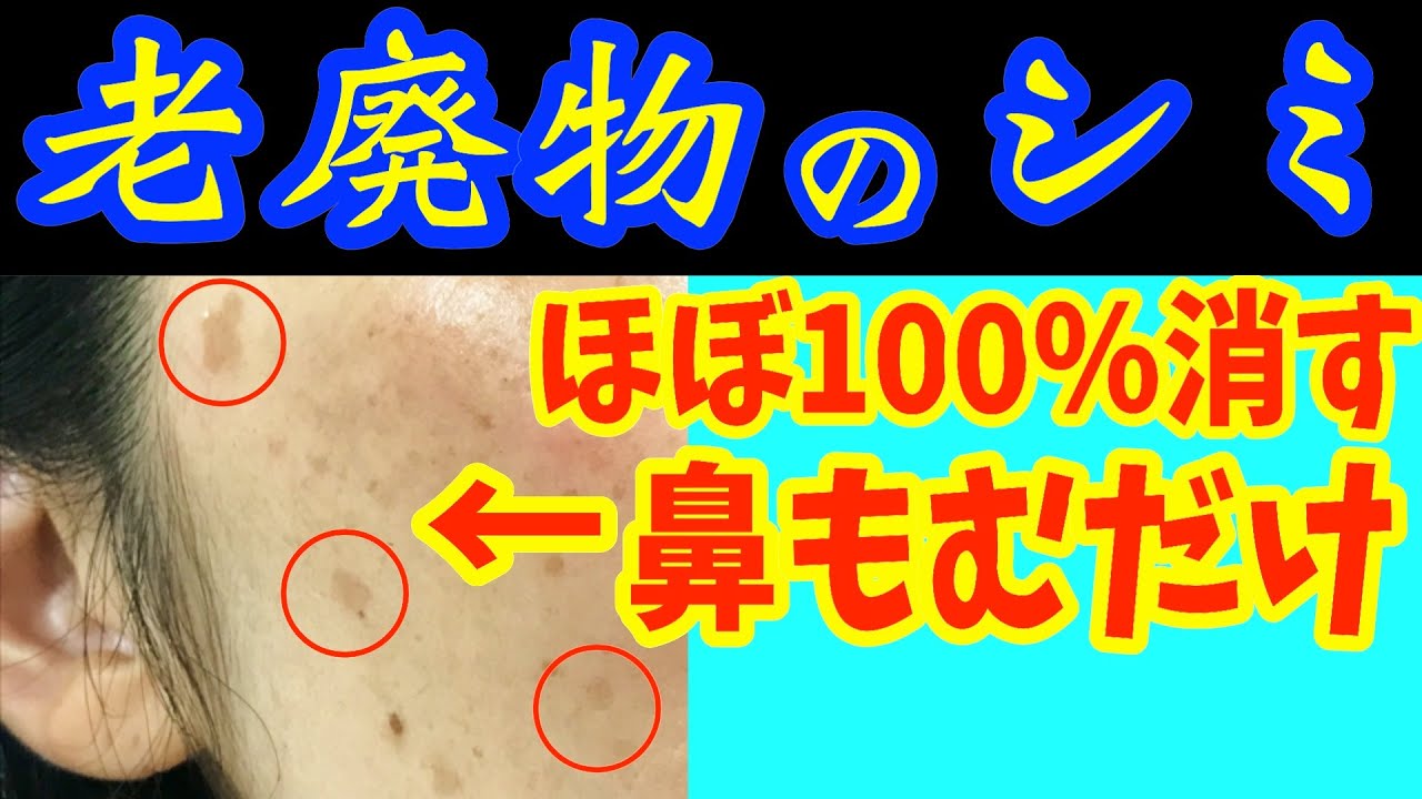 寝る前に騙されたと思ってシミ消し‼鼻をつまむだけでほうれい線、ゴルゴライン、白髪をなくす方法で垢抜け！目の下・顔のたるみも解消しガチガチ首コリまで一瞬で楽になるスキンケア【ダイエット整体師】