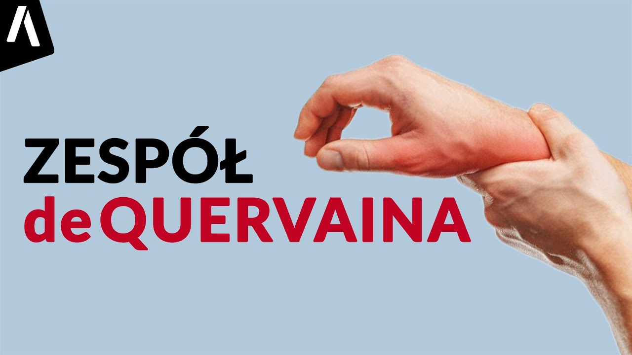 Zespół de Quervaina I Przyczyny, diagnostyka i leczenie