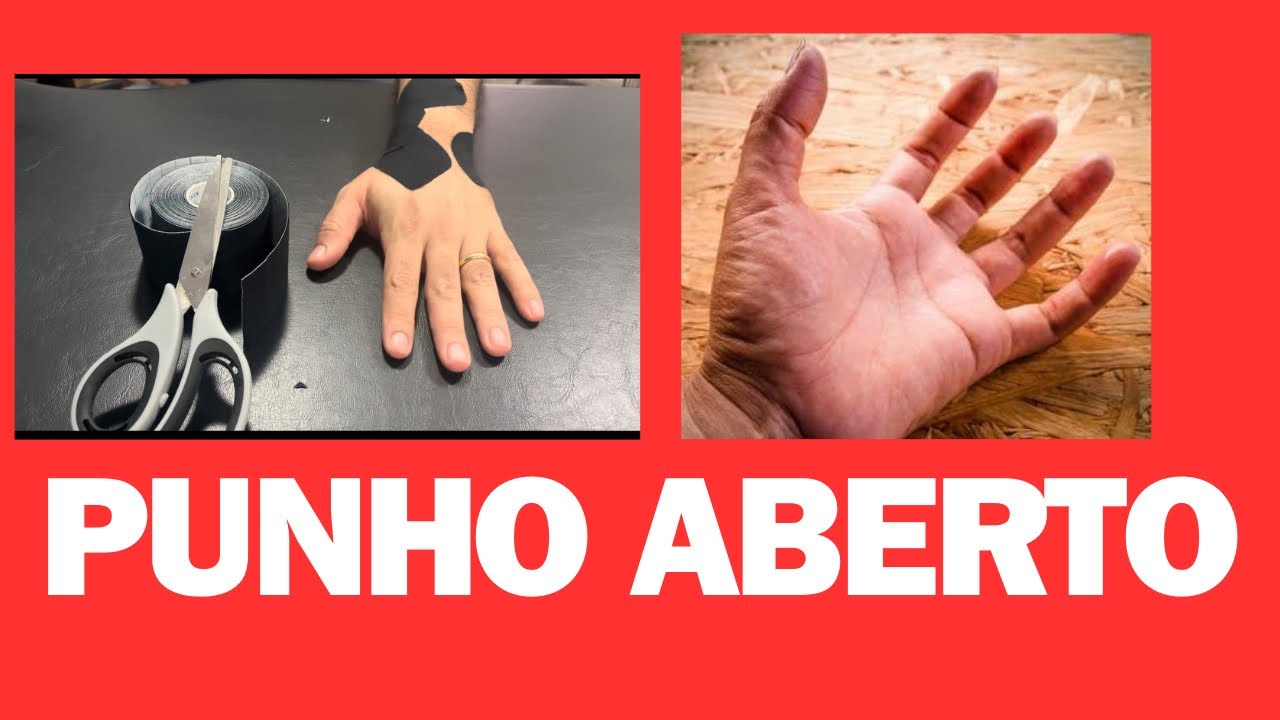ESTABILIZAÇÃO DO PUNHO ABERTO COM KINESIO TAPING #esporte #voleibol #tendinite