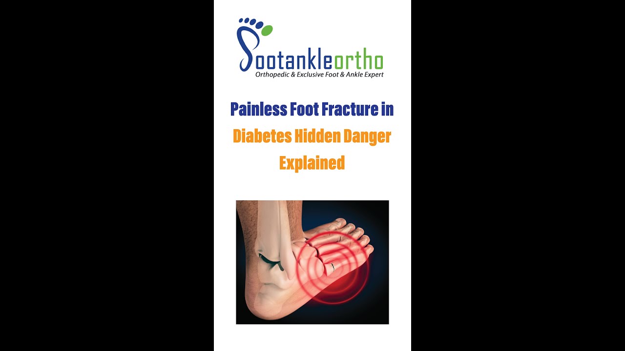 Painless Foot Fracture in Diabetes | Hidden Danger Explained
