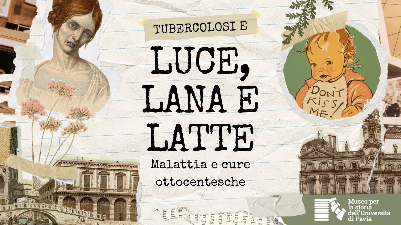 Tubercolosi e 