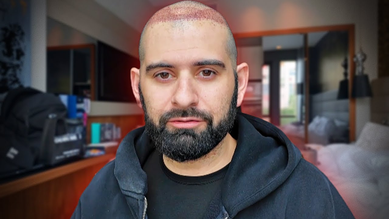 A Hypebeast Hair Transplant