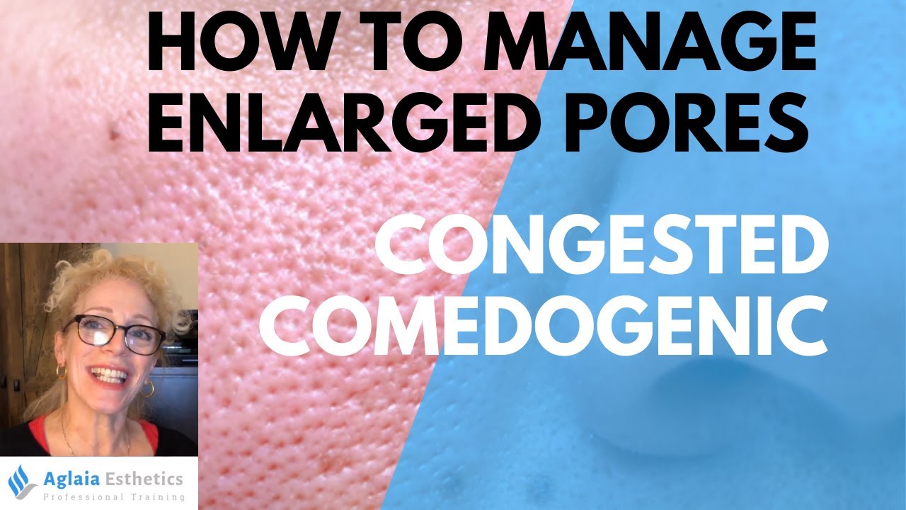CAN YOU REALLY SHRINK BIG PORES? FIND OUT!