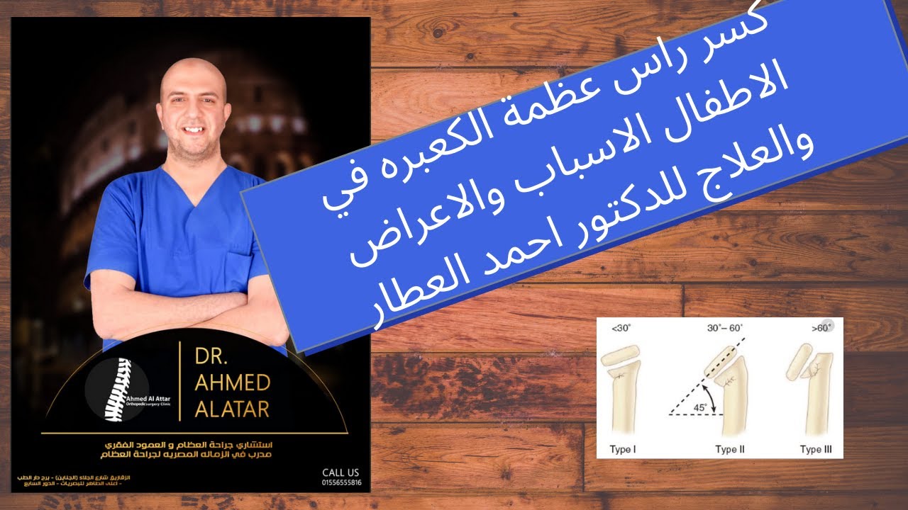 كسر الكعبره - راس الكعبره بالاطفال للدكتور احمد العطار