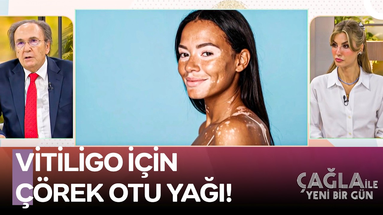 İbrahim Saraçoğlu'ndan Vitiligoya Bitkisel Öneriler - Çağla ile Yeni Bir Gün 1598. Bölüm