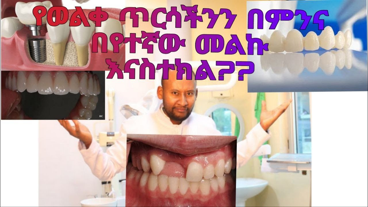 ሰው ሰራሽ ጥርስ  ከማስተከላችን በፊት እዚህ ላይ የተዘረዘሩ  ነግሮች ማወቅ ግድ ይለናል። እንዲሁም የትኛውን ብናስተክል የተሻለ ነው ??