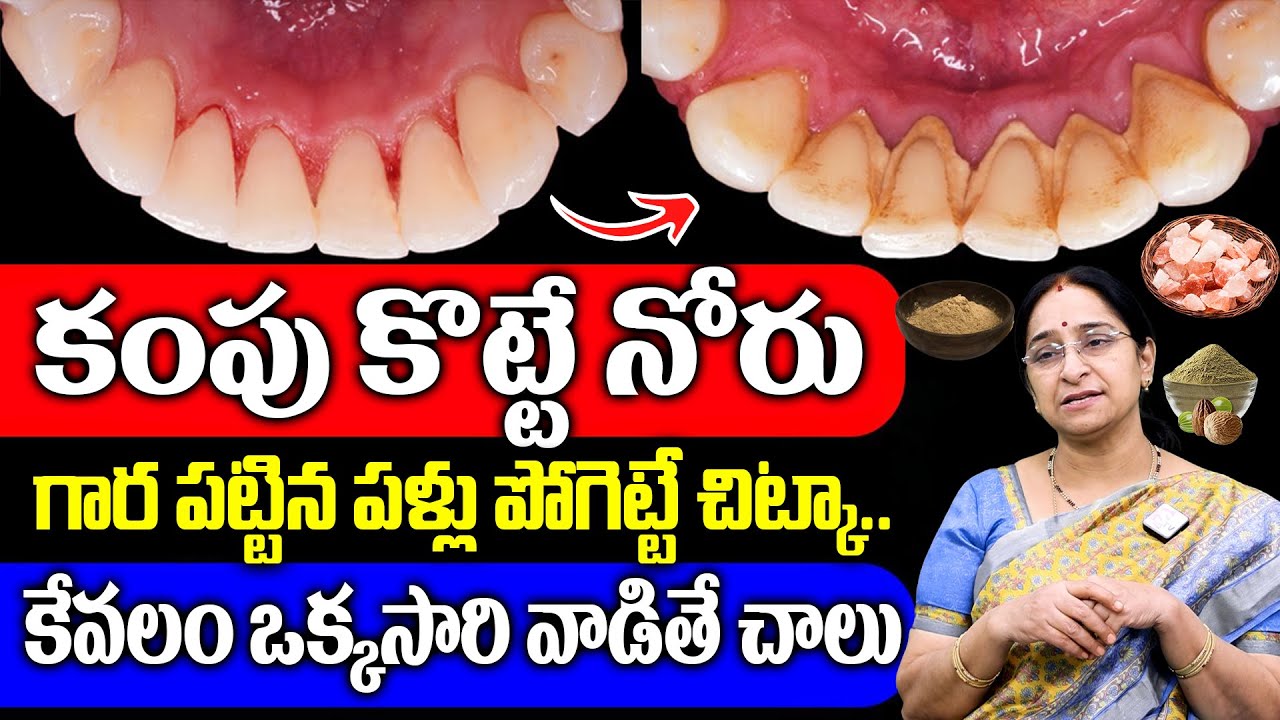 Ramaa Raavi - కంపు కొట్టే నోరు గార పట్టిన పళ్ళు పోగొట్టే చిట్కా.. | Mouth Bad Smell Remedy