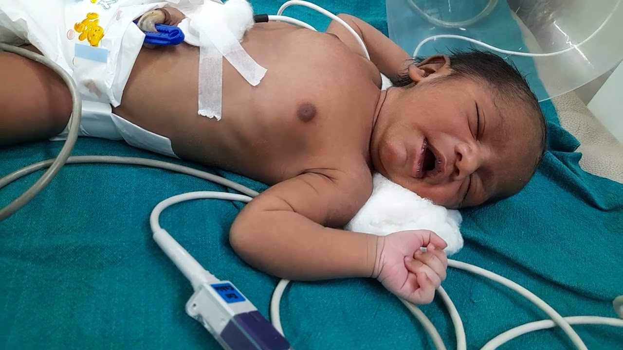icu baby care ______________🙏🙏🙏watch full video_____🙏🙏🙏🙏