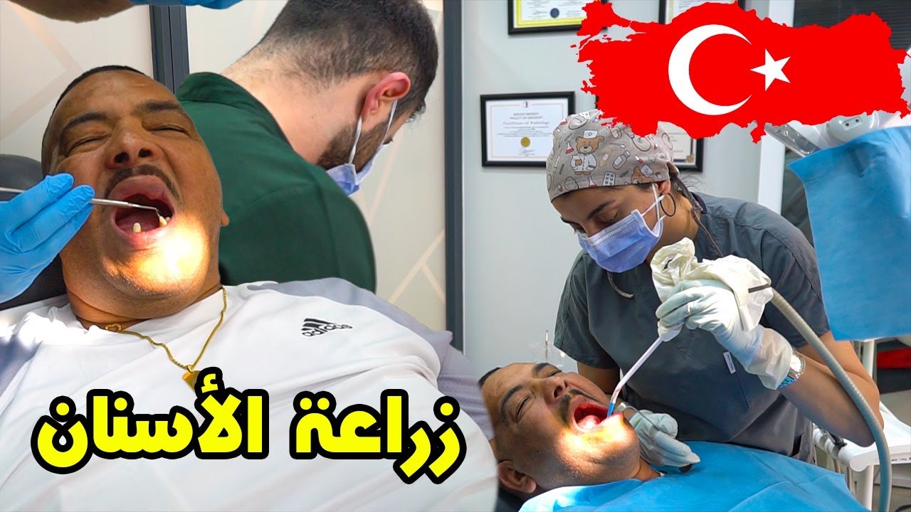 نيبا حيدو ليه سنانو مسكين🤪 او دارت ليه صوفيا طالوني 😵‍💫زراعة الأسنان