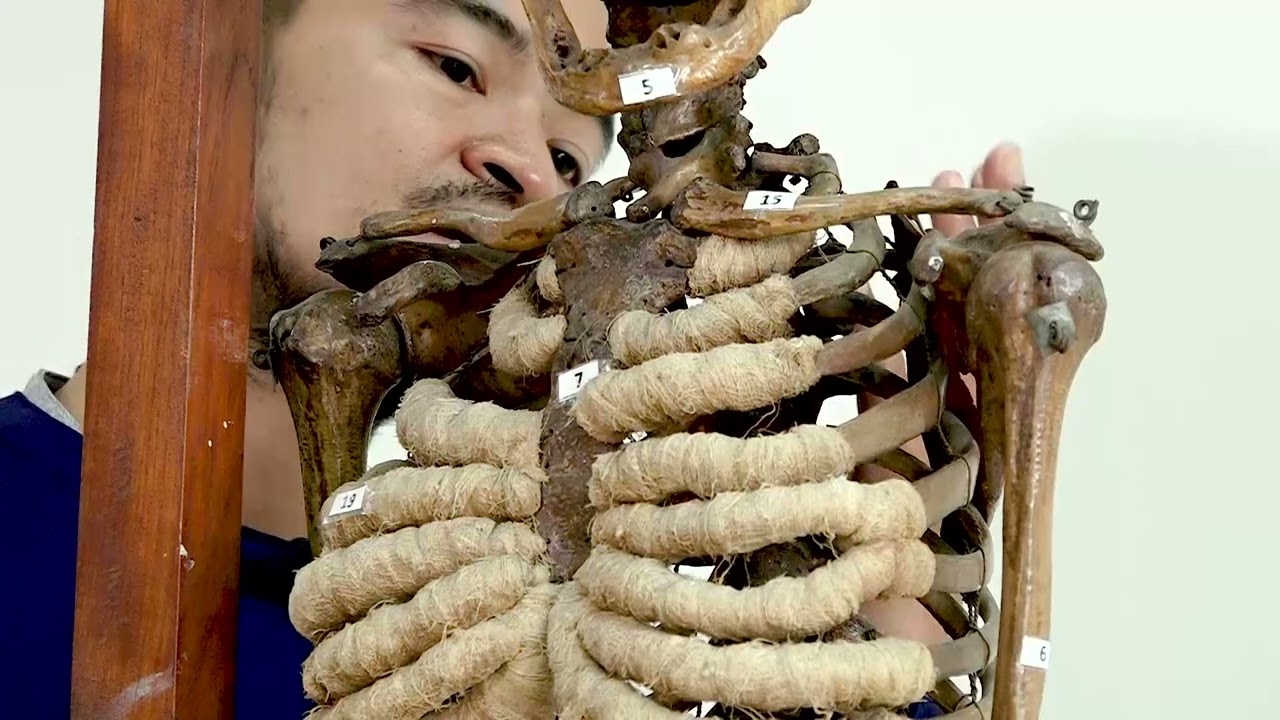 ANATOMI FISIOLOGI PADA SENDI BAHU || FISIOTERAPI 2022