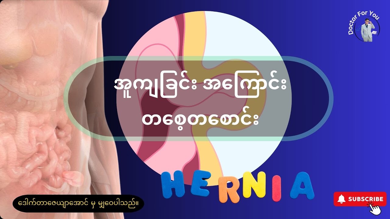 အူကျခြင်း (Hernia) အကြောင်း တစေ့တစောင်း