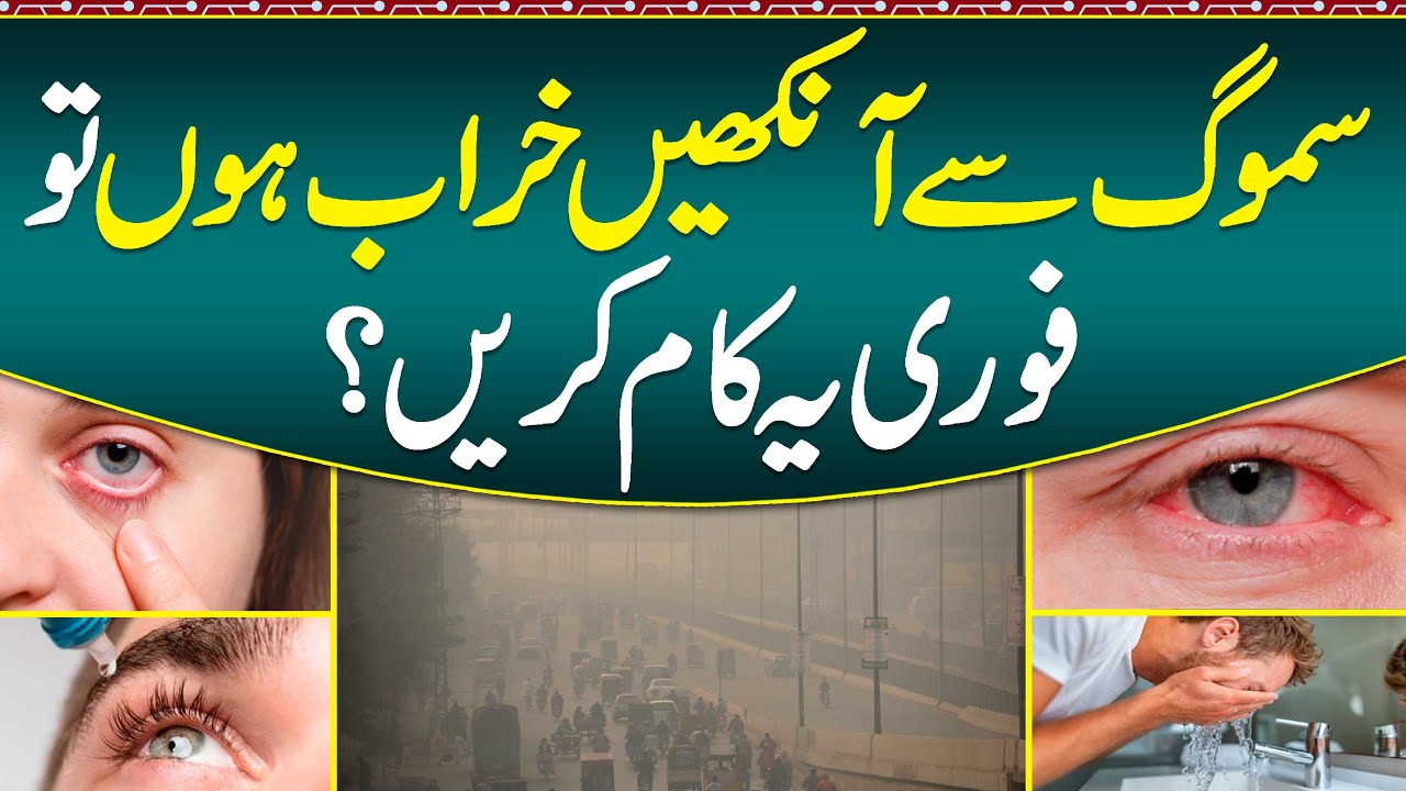Smog Se Aankhon Me Jalan Ka ilaj -Smog Effects On Eyes & Prevention - How Affected Smog On Our Eyes?