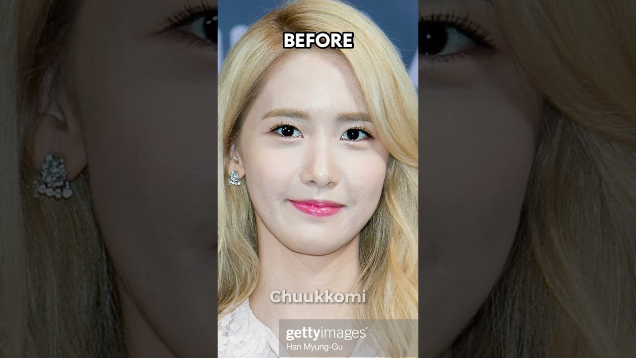 Kpop idols that had acne: before vs after Part 1#kpop