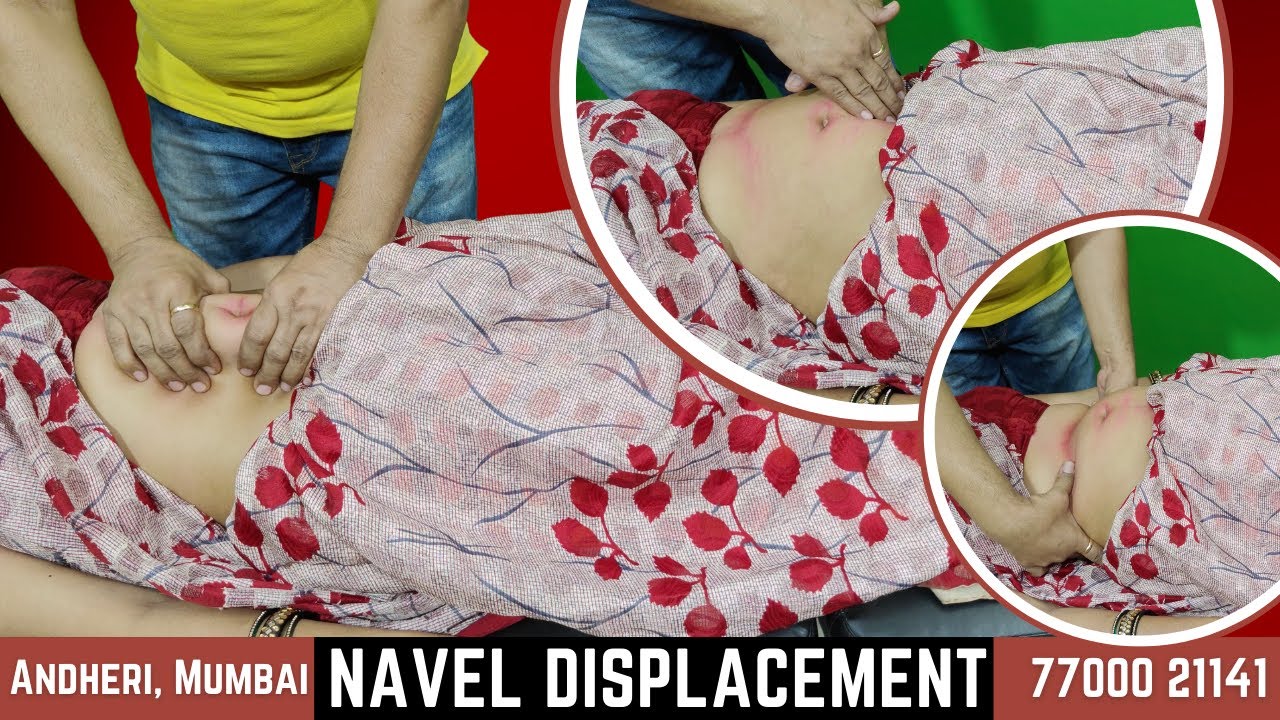 Navel displacement, Constipation, Gas and acidity, Abdominal pain and swelling - Get Fastest relief