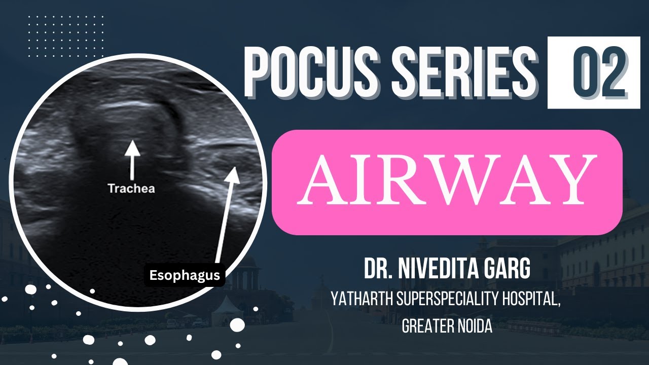 POCUS Airway: Революция в управлении дыхательными путями с помощью ультразвука I. Доктор Ниведита...