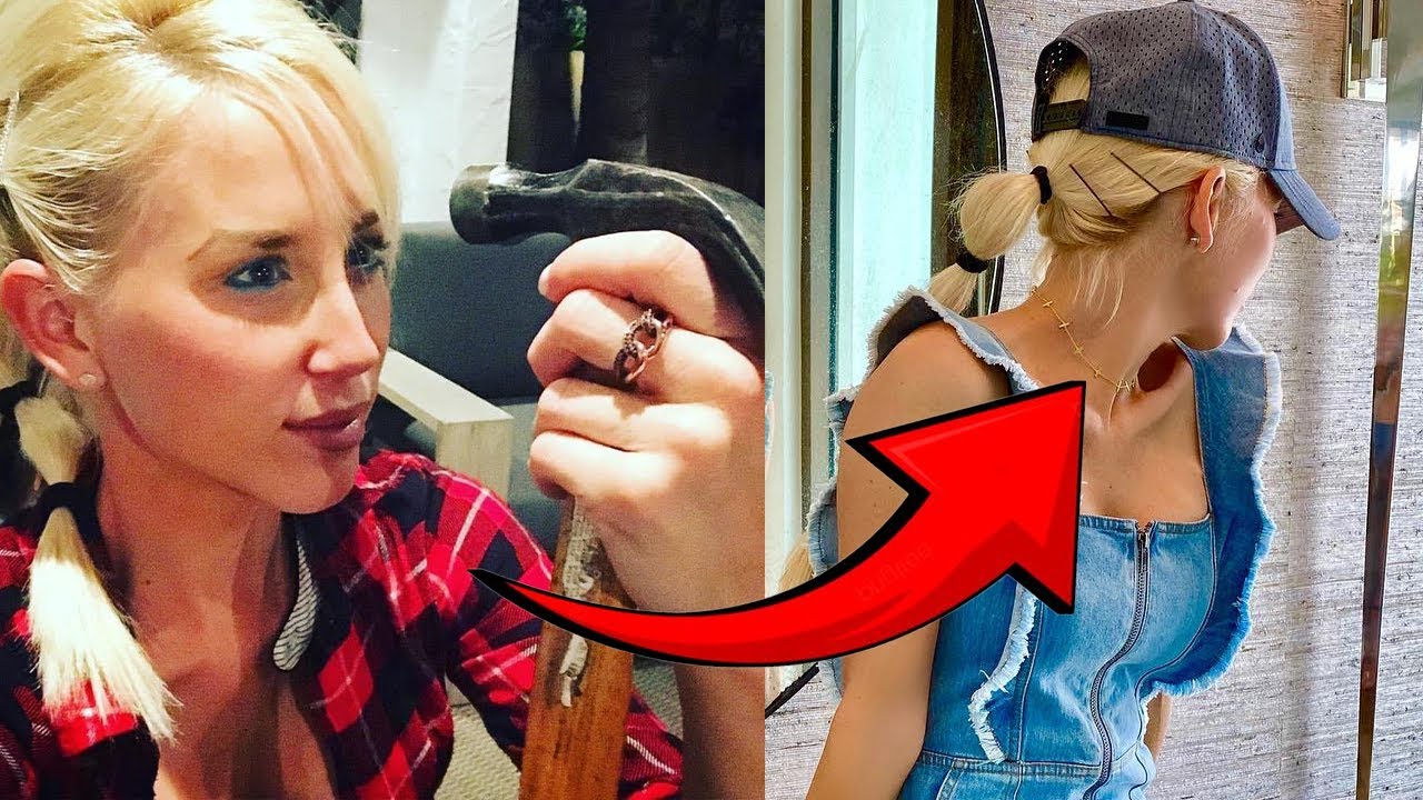 Что не так с лицом Гейли Аликс? Вот почему она всегда носит шляпу. #hgtv