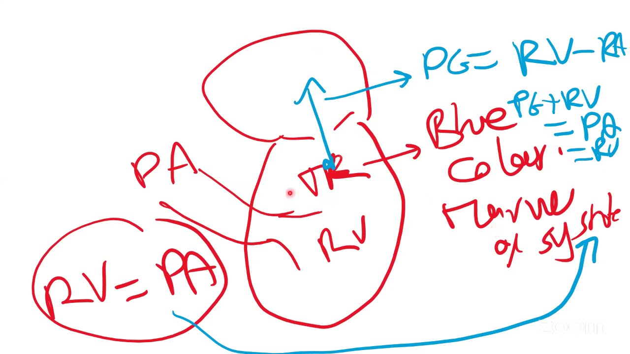 Pulmonary Hypertension and pulmonary vasodilators Prof Antoine Fakhry AbdelMassih
