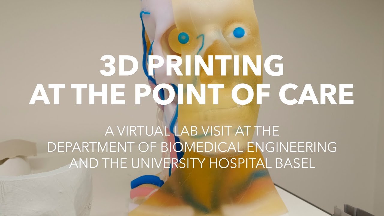 3D Printing at the Point of Care at the University Hospital Basel, Switzerland